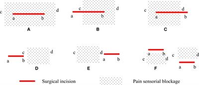 Comparison of the feasibility and validity of a one-level and a two-level erector spinae plane block combined with general anesthesia for patients undergoing lumbar surgery